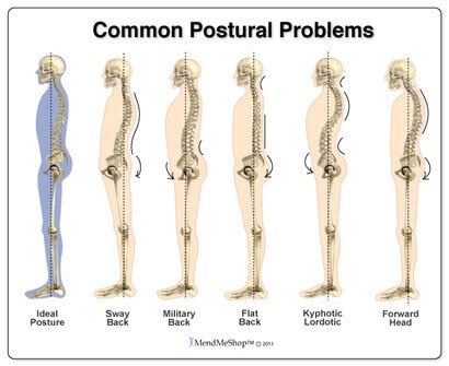 Postural Correction and Assistance with Kinesio Taping