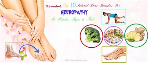 Top 10 Natural Home Remedies For Neuropathy In Hands, Legs, Feet