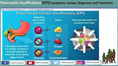 Pancreatic Insufficiency (EPI) Symptoms, Causes, Diagnoses and ...