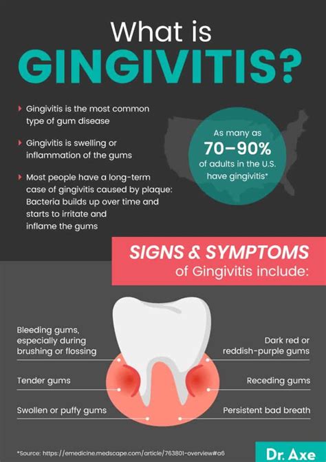 Gingivitis Symptoms and How to Get Rid of Gum Disease - Dr. Axe