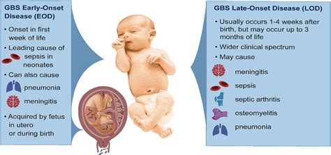 Frontiers | Bacterial and Host Determinants of Group B Streptococcal Infection of the Neonate ...