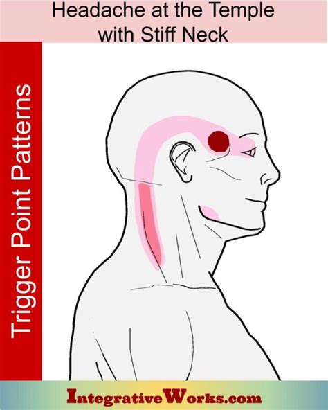 Headache At Your Temple with Stiff Neck - Integrative Works