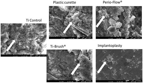 Scanning electron micrographs of Streptococcus Gordonii biofilm ...