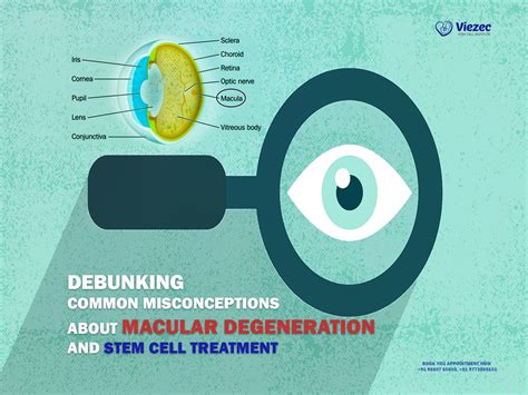 Misconceptions About Macular Degeneration and Stem Cell Treatment
