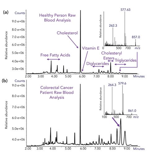 Gas Chromatography Mass Spectrometry Gc Ms Chromatograms Full Scan | Hot Sex Picture