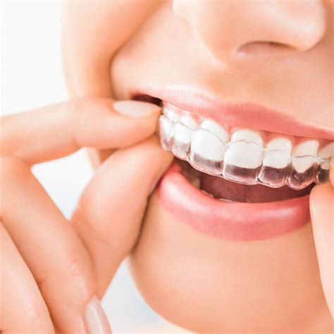 Invisalign – Invisible Braces - Apex Dental Care