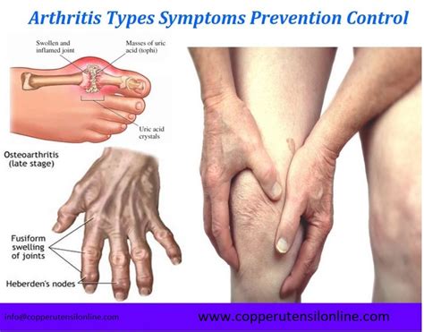 Arthritis Symptoms, Types, Causes, Definition & Diet – CopperUtensilOnline