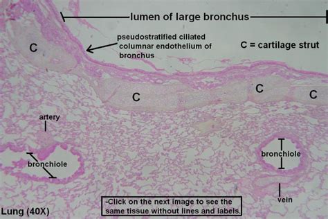 Bronchi and Bronchioles – Tutorial – Histology Atlas for Anatomy and ...