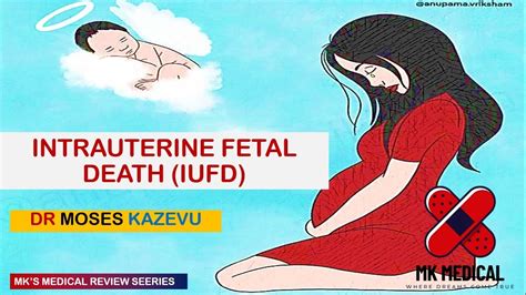 Intrauterine Fetal Demise/Death || IUFD - YouTube