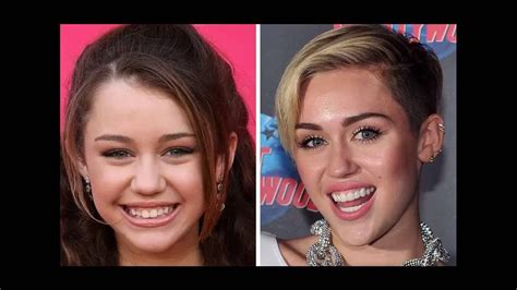 Miley Cyrus Braces Before After. How to get celebrities smile. Top 10 ...