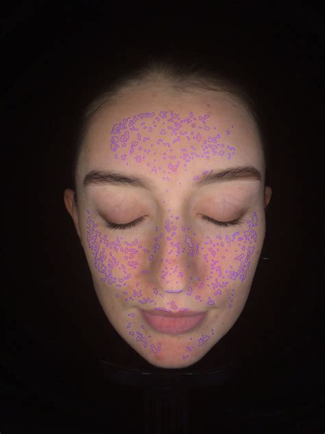 Uv Light Facial Skin Scanner Skin Analysis Machine Salon Beauty Machine Meicet Mc10 - Buy Uv ...