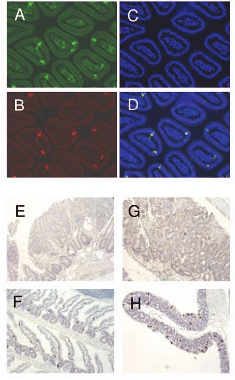 Staining of enterochromaffin cells in normal intestine and adenomas.... | Download Scientific ...