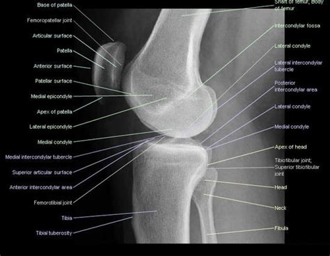 Radiographic Positioning Examples of the Leg and Knee - CE4RT