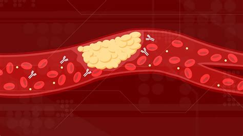 Scientists identified the cause of COVID-19 blood clots