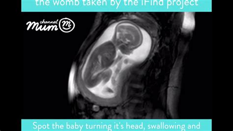 MRI Scan Video of Baby Moving in Womb | Channel Mum - YouTube