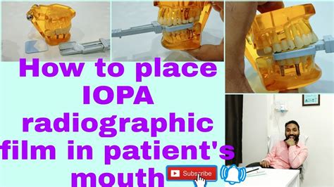 How to place IOPA radiographic film in patient's mouth?/#x-ray #radiograph/bisecting angle ...