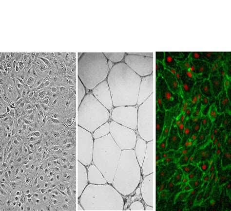 Pre-screened endothelial cells validated for signalling biomarkers - Tebubio's blog