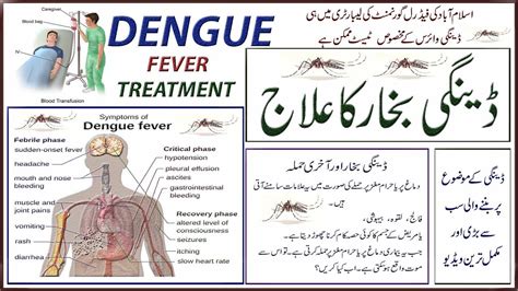 Dengue Fever Desi Treatment In Hindi - andre