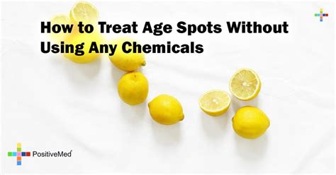 How to Treat Age Spots Without Using Any Chemicals