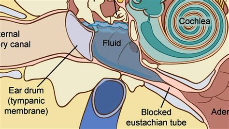 Fluid in the Ear | SiOWfa14 Science in Our World: Certainty and Cont