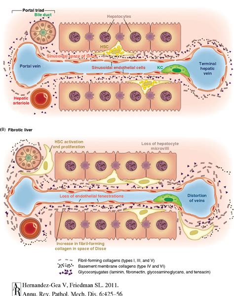 Figure 3 from Hepatic stellate cells and liver fibrosis. | Semantic Scholar