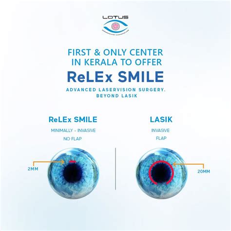 ReLEx Smile, Beyond Lasik Surgery - Lotus Eye Hospital Coimbatore in ...