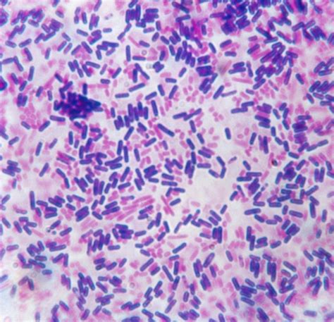 Gram Stain Procedure in Microbiology