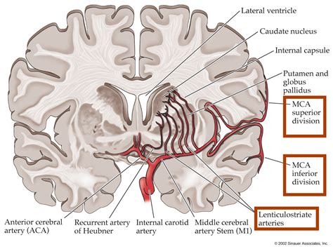 Middle Cerebral Artery (MCA) - Stepwards