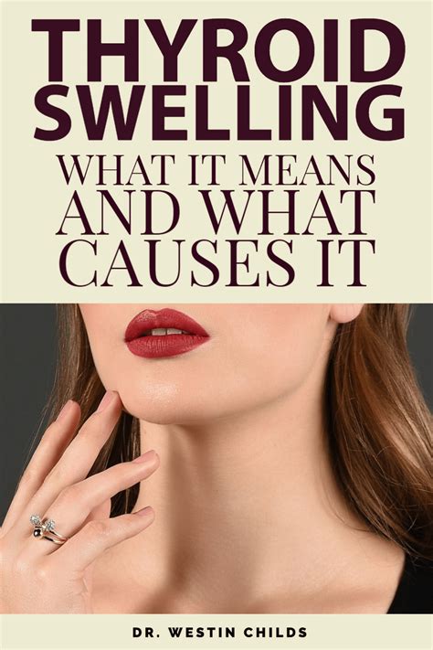 Thyroid swelling what it means and what causes it – Artofit