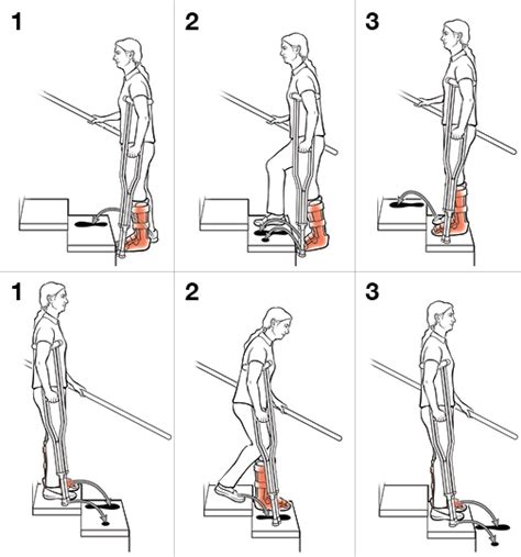 Step-by-Step: Using Crutches on Stairs | Saint Luke's Health System