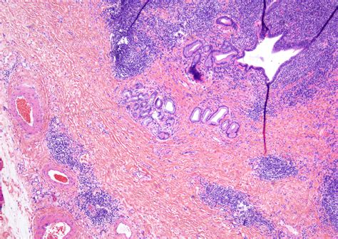 Liver Histology Bile Duct