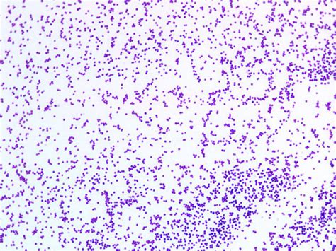 Staphylococcus Epidermidis Gram Stain