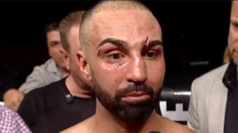 Bare Knuckle FC: Artem Lobov defeats Paulie Malignaggi, result, video