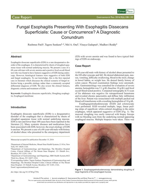 (PDF) Fungal Esophagitis Presenting With Esophagitis Dissecans ...