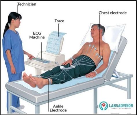 Electrocardiogram (ECG) Test: Procedure, Results And Risks, 43% OFF