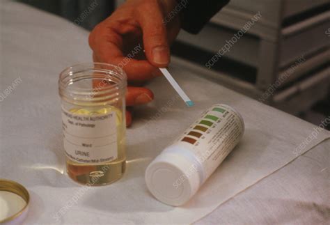 Urine Glucose Reference Range at Sarah Janes blog