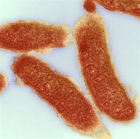 Cholera Bacteria Photograph by Ami Images/science Photo Library - Fine ...