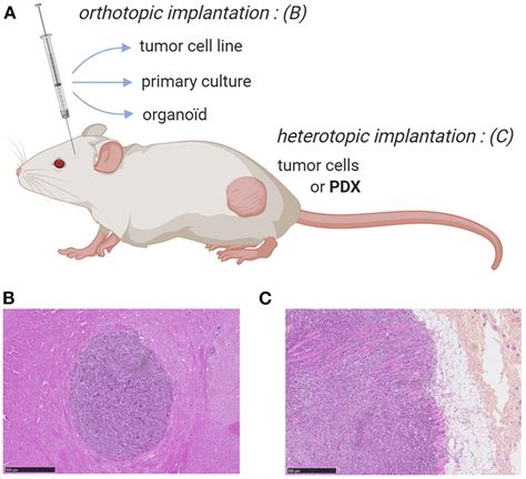 | Mouse models for ortho-or heterotopic administrations of human tumor ...