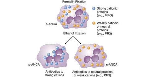 Anti-Neutrophil Cytoplasmic Antibody (Anca) copy - New