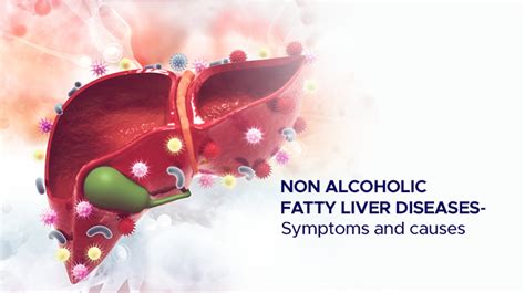 Non Alcoholic Fatty Liver Diseases- Symptoms and Causes - Ailbs India