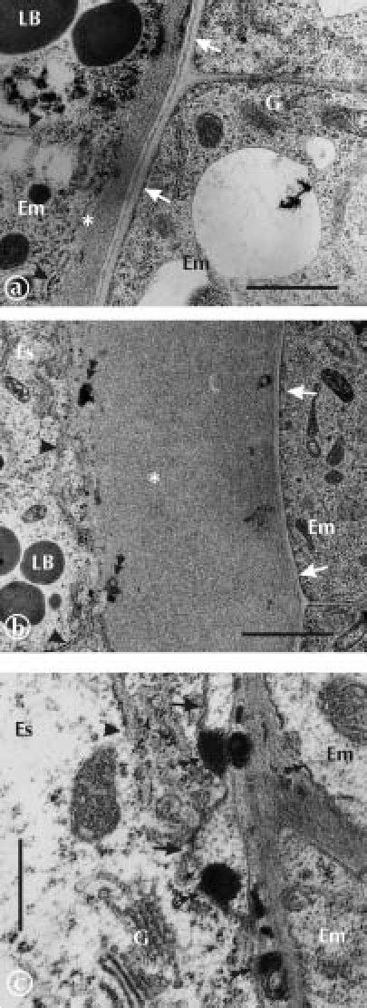 Boundary of endosperm and testa in developing seed. Es – endosperm; Et... | Download Scientific ...