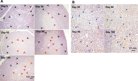 Immunohistochemistry of annexin A5 (ANXA5) in rat thymus tissue. The ...