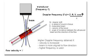 Doppler Physics: DOPPLER ULTRASOUND : PRINCIPLES & PRACTICE