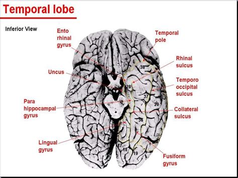 Anatomy of brain sulcus and gyrus - Dr.Sajith MD RD