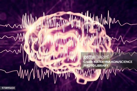 163 Epilepsy Brain Waves Stock Photos, High-Res Pictures, and Images - Getty Images