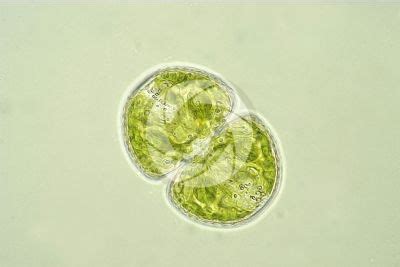 Cosmarium sp. - Cosmarium - Charophyta (Green algae) - Algae - Microbiology - Plant histology ...