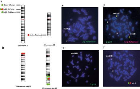 FISH on chromosomes 2 and 12 implicated in the balanced translocation ...