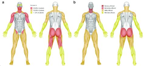 Distribution of skeletal muscle weakness (a) and severity of weakness ...