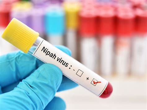 Nipah Virus Infection: Symptoms, Causes, Diagnosis, Treatment & More