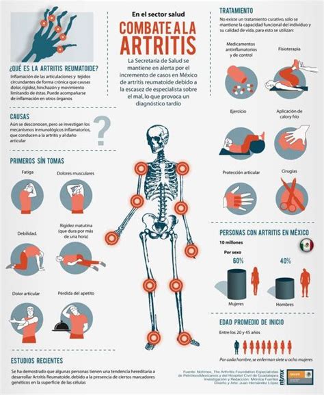 Artritis, que es, causas y maneras de combatirla, entre ellas la #fisioterapia | Fisioterapia ...